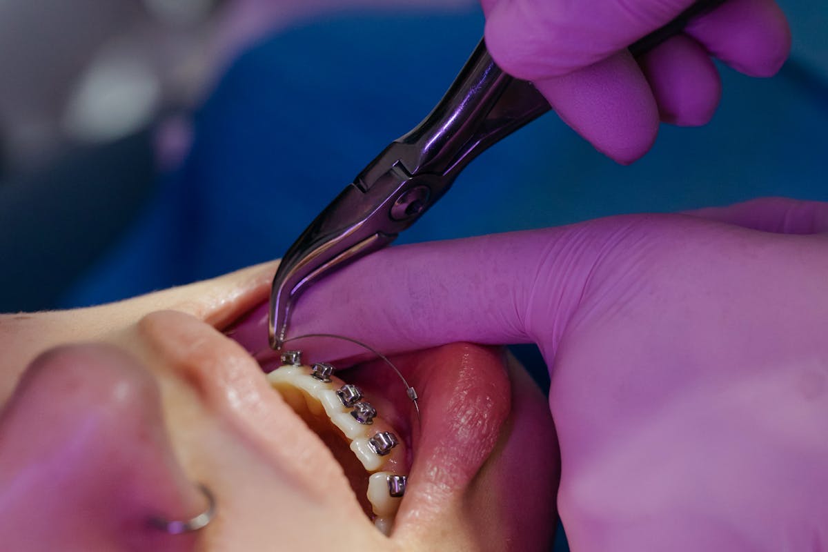 Top 10 Orthodontics Marketing Trends for 2024